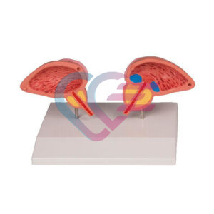 Model prostate, 2 dijela