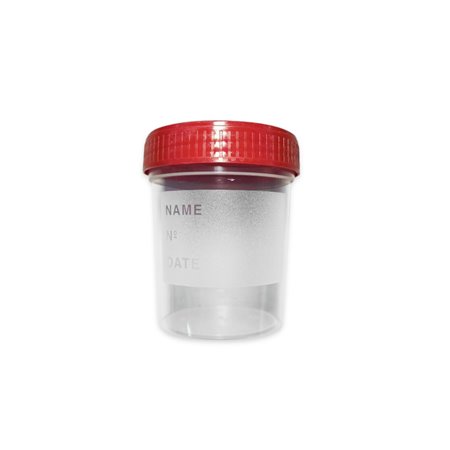 Posuda za urin, sterilna, 150 ml