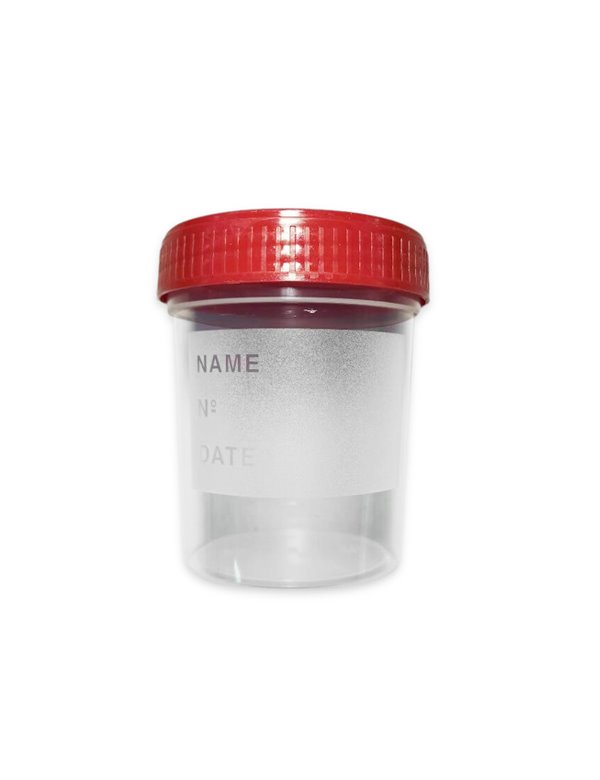 Posuda za urin, sterilna, 150 ml